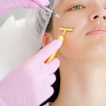 Best botox for acne scars