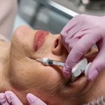 botox for acne scars