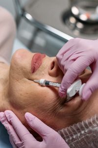 botox for acne scars