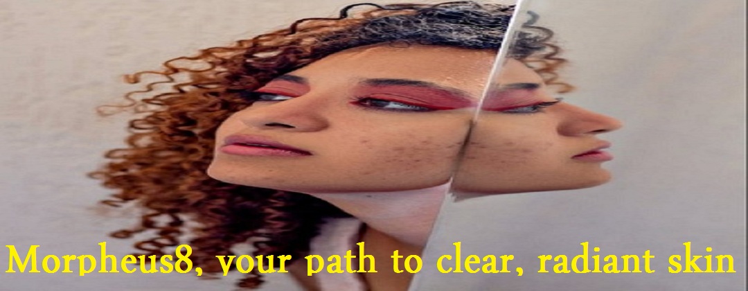 morpheus8 acne scars